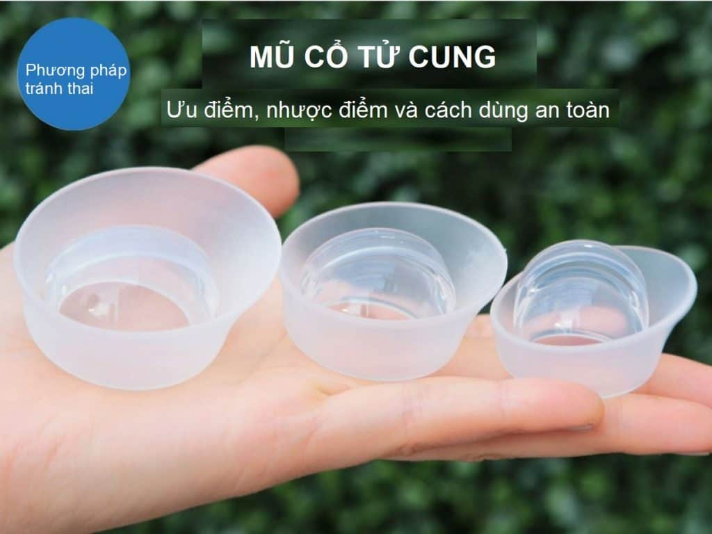 Mũ chụp cổ tử cung có thể dùng được trong bao lâu?
