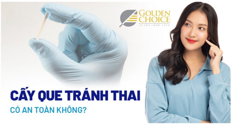 Cấy que tránh thai là một trong những biện pháp tránh thai có hiệu quả tốt.