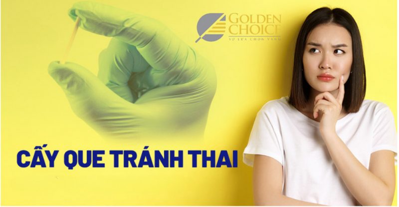 Que cấy tránh thai được nhiều mẹ sau sinh lựa chọn