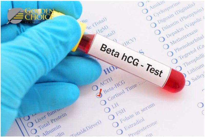 Xét nghiệm beta-hCG giúp xác định tình trạng mang thai với độ chính xác cao nhất